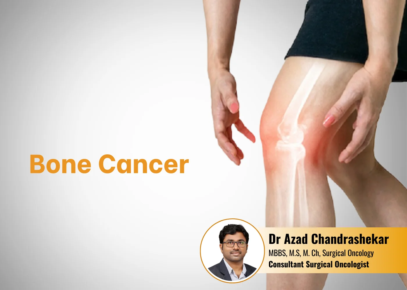 Bone-Cancer treatment in Hyderabad